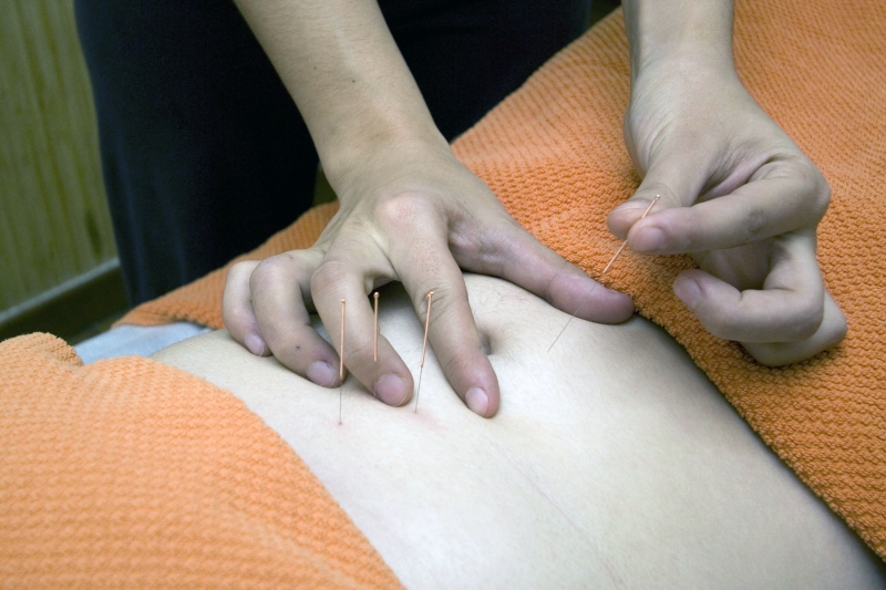 osteopathe-PIERREFEU-min_acupuncture-4175625